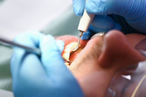 Best Emergency Dentist for Knocked-Out Tooth in East Flat Rock, NC