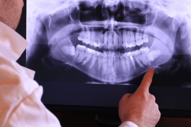 Best Urgent Dental Care for Toothache in East Flat Rock, NC