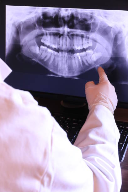 Best Emergency Root Canal Treatment in East Flat Rock, NC