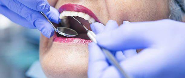 Best Emergency Dentist for Lost Fillings or Crowns in East Flat Rock, NC