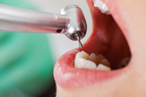 Best Weekend Emergency Dentist in East Flat Rock, NC